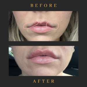 black and white lash tech before and after instagram post 2