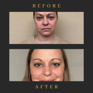 black and white lash tech before and after instagram post 3