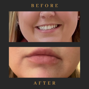 black and white lash tech before and after instagram post