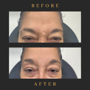 black and white lash tech before and after instagram post 4