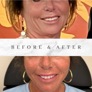 marble before and after lash tech instagram post