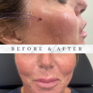 marble before and after lash tech instagram post 3