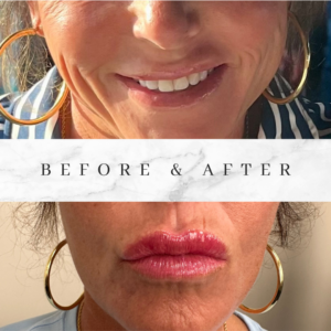 marble before and after lash tech instagram post